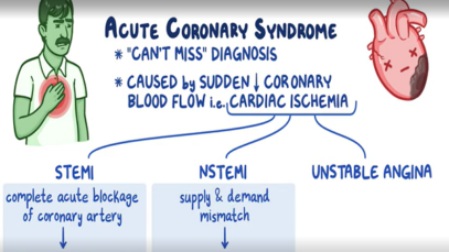 Acute coronary syndrome_ Clinical sciences