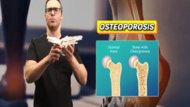 BEST Bone Health Osteoporosis Treatment Remedies