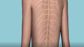 Don t suffer with shingles