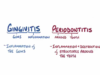 Gingivitis and periodontitis causes, symptoms, diagnosis, trea