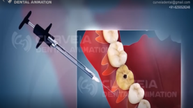 Symptoms Signs of a Heart Attack in Women Men Mass General