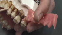 What is Periodontal Disease