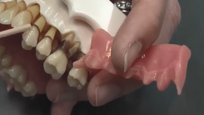 What is Periodontal Disease