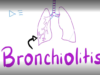 Acute Bronchiolitis, Bronchiolitis Obliterans Organizing Pneumon