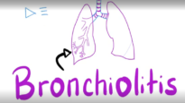 Acute Bronchiolitis, Bronchiolitis Obliterans Organizing Pneumon