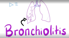 Acute Bronchiolitis, Bronchiolitis Obliterans Organizing Pneumon