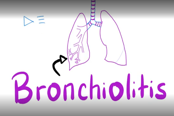 Acute Bronchiolitis, Bronchiolitis Obliterans Organizing Pneumon