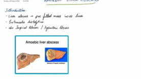 Amebic Liver Abscess – General Surgery