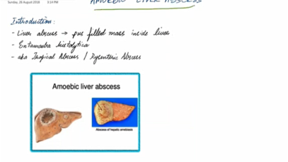 Amebic Liver Abscess – General Surgery