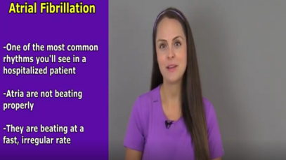 Atrial Fibrillation A Fib ECG, Treatment, Causes