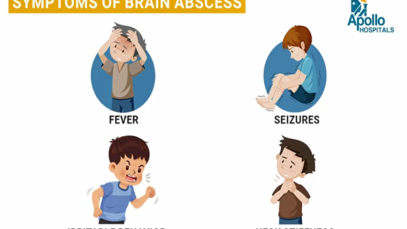 Brain Abscess in Children