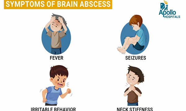 Brain Abscess in Children