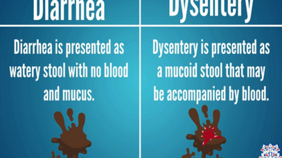 Differences between Diarrhea and Dysentery
