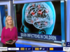 Doctor offers hypothesis on what s causing brain abscesses in So