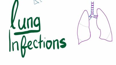 Lung Infections Lung Abscess, Empyema, Fistula, Aspiration Syn