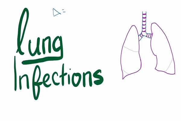 Lung Infections Lung Abscess, Empyema, Fistula, Aspiration Syn