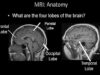 Normal Brain MRI Anatomy