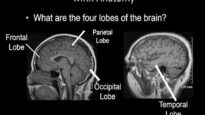 Normal Brain MRI Anatomy