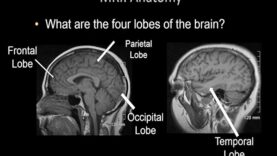 Normal Brain MRI Anatomy