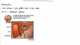 Pyogenic Liver Abscess – General Surgery