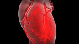 What is a myocardial infarction or heart attack