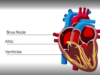 What is atrial fibrillation