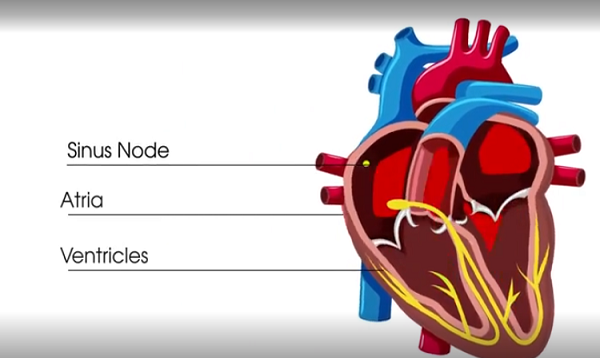 What is atrial fibrillation