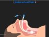 Anatomy of the Endotracheal Tube ET Tube Airway Management