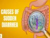 Causes of Sudden Diarrhea