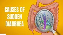 Causes of Sudden Diarrhea