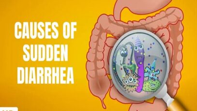 Causes of Sudden Diarrhea