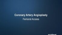 Coronary Angioplasty (Femoral Access)