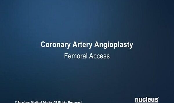 Coronary Angioplasty (Femoral Access)