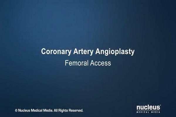 Coronary Angioplasty (Femoral Access)