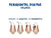 Diagnosis of Periodontitis