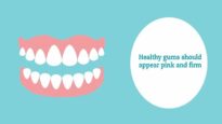 Explaining gum disease