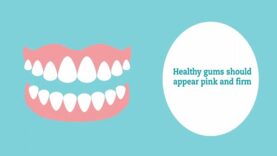 Explaining gum disease