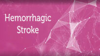 Hemorrhagic-stroke-Causes-and-treatments