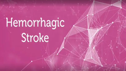 Hemorrhagic-stroke-Causes-and-treatments