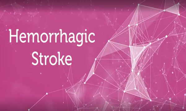 Hemorrhagic-stroke-Causes-and-treatments