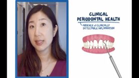 Plaque-induced Periodontal Disease Diagnosis (in Collaboration w Western University)