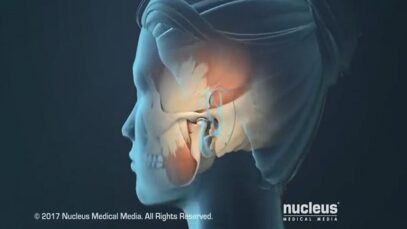 TMJ Pain Headaches, Earaches and Spasms