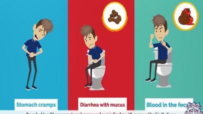 What is Dysentery Causes, Signs and symptoms, Diagnosis and tre