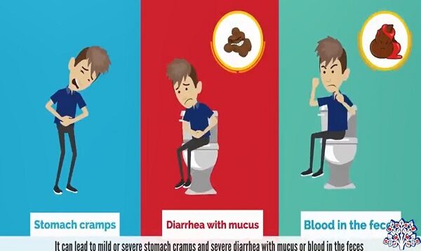 What is Dysentery Causes, Signs and symptoms, Diagnosis and tre