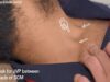 Examination of the Jugular Venous Pressure JVP Clinical Exam