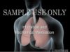 Intubation Mechanical Ventilation (Ventilator)