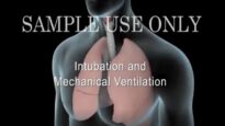 Intubation Mechanical Ventilation (Ventilator)