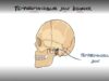Temporomandibular Joint Disorder Explained TMJ Dysfunction I