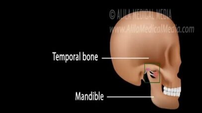 Temporomandibular Joint TMJ Anatomy and Disc Displacement Anim