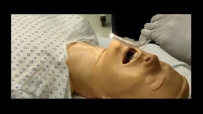 Tracheal intubation (lighted stylet)